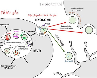 Liệu pháp chất tiết tế bào gốc (exosome)